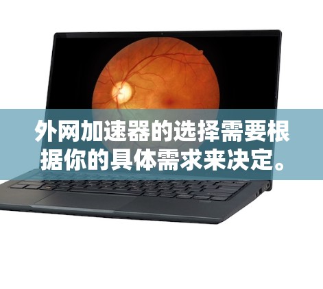 外网加速器的选择需要根据你的具体需求来决定。以下是一些常见的外网加速器推荐，供你参考